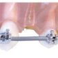 Archwire sleeve protective tubing